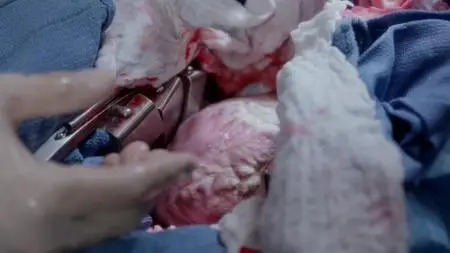 Grey's Anatomy S12E17