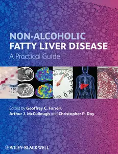 Non-Alcoholic Fatty Liver Disease: A Practical Guide (Repost)