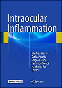 Intraocular Inflammation (repost)