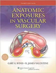 Anatomic Exposures in Vascular Surgery (Repost)