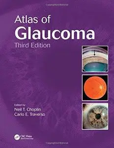 Atlas of Glaucoma, Third Edition (Repost)