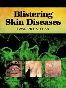 Blistering Skin Diseases [Repost]