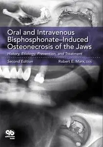 «Oral and Intravenous Bisphosphonate: Induced Osteonecrosis of the Jaws: History, Etiology, Prevention, and Treatment (S