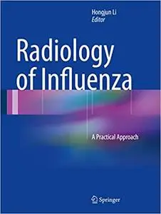 Radiology of Influenza: A Practical Approach (Repost)