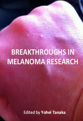 "Breakthroughs in Melanoma Research" ed. by Yohei Tanaka