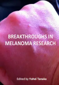 "Breakthroughs in Melanoma Research" ed. by Yohei Tanaka