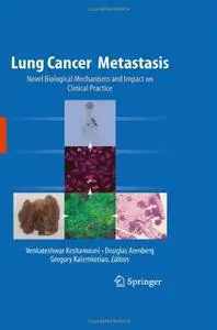 Lung Cancer Metastasis: Novel Biological Mechanisms and Impact on Clinical Practice (Repost)