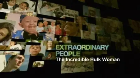 Ch5 Extraordinary People - The Incredible Hulk Woman (2014)
