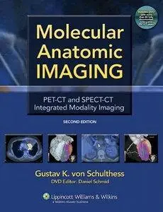 Molecular Anatomic Imaging: PET-CT and SPECT-CT Integrated Modality Imaging, 2nd Edition