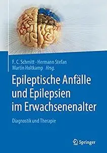 Epileptische Anfälle und Epilepsien im Erwachsenenalter