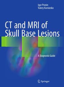 CT and MRI of Skull Base Lesions: A Diagnostic Guide (Repost)