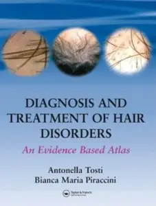 Diagnosis and Treatment of Hair Disorders: An Evidence-Based Atlas (repost)