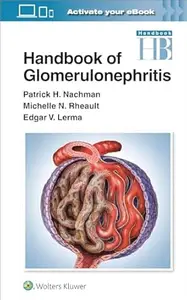 Handbook of Glomerulonephritis