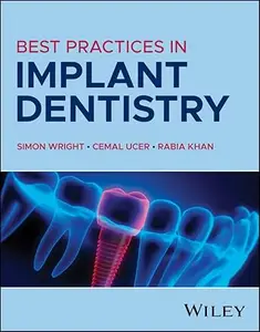 Best Practices in Implant Dentistry