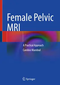 Female Pelvic MRI: A Practical Approach