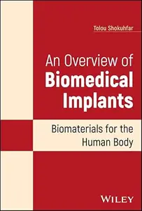 An Overview of Biomedical Implants