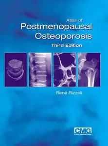 Atlas of Postmenopausal Osteoporosis, 3rd Edition (repost)