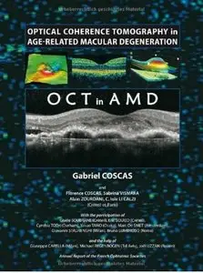 Optical Coherence Tomography in Age-Related Macular Degeneration (repost)