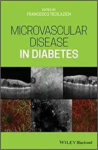 Microvascular Disease in Diabetes