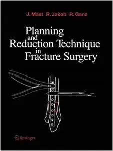 Planning and Reduction Technique in Fracture Surgery