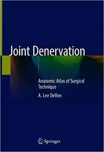 Joint Denervation: An Atlas of Surgical Techniques (Repost)