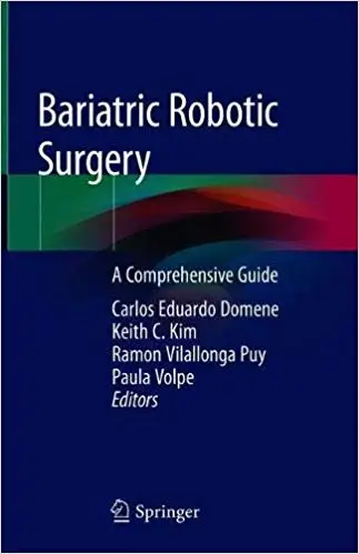 Bariatric Robotic Surgery: A Comprehensive Guide
