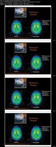 Power of the Mind in Health and Healing