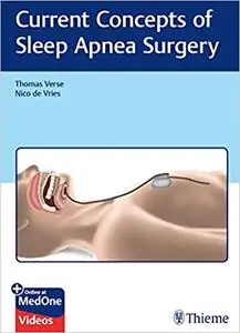 Current Concepts of Sleep Apnea Surgery