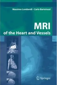 MRI of the Heart and Vessels
