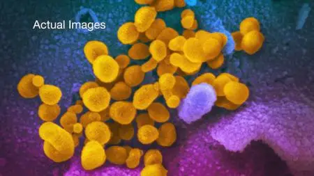 Curiosity TV - Breakthrough: The Coronavirus Epidemic (2020)