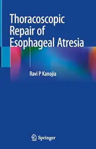 Thoracoscopic Repair of Esophageal Atresia