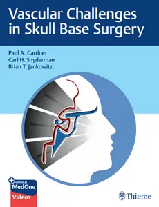 Vascular Challenges in Skull Base Surgery (repost)