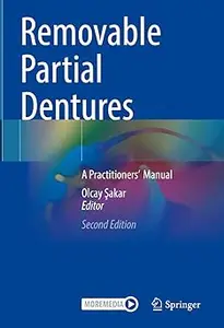 Removable Partial Dentures: A Practitioners’ Manual