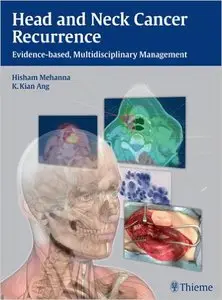 Head and Neck Cancer Recurrence: Evidence-based, Multidisciplinary Management