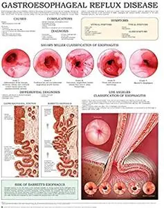 Gastroesophageal reflux disease e-chart: Quick reference guide