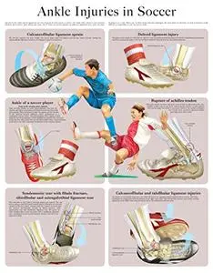 Ankle Injuries in Soccer e-chart: Quick reference guide