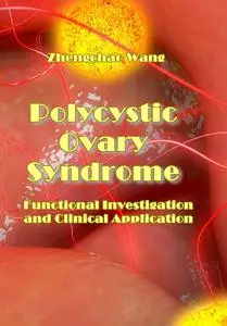 "Polycystic Ovary Syndrome: Functional Investigation and Clinical Application" ed. by Zhengchao Wang