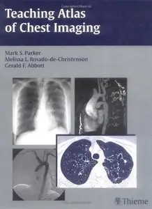 Teaching Atlas of Chest Imagin (Repost)