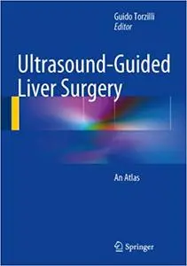 Ultrasound-Guided Liver Surgery: An Atlas (Repost)