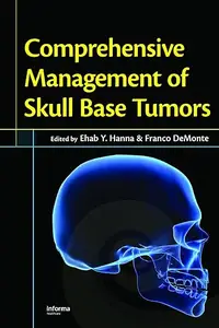 Comprehensive Management of Skull Base Tumors