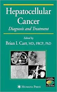 Hepatocellular Carcinoma: Diagnosis and Treatment, Second Edition