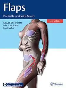 Flaps: Practical Reconstructive Surgery [Kindle Edition]