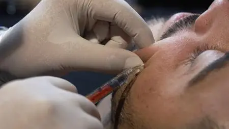 ABC Catalyst - Forever Young? The Rise Of Injectables (2022)