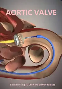 "Aortic Valve" ed. by Ying-Fu Chen and Chwan-Yau Luo