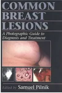 Common Breast Lesions: A Photographic Guide to Diagnosis and Treatment