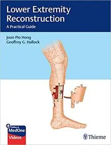 Lower Extremity Reconstruction: A Practical Guide