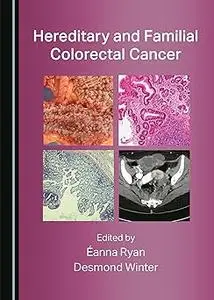 Hereditary and Familial Colorectal Cancer