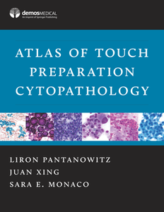 Atlas of Touch Preparation Cytopathology