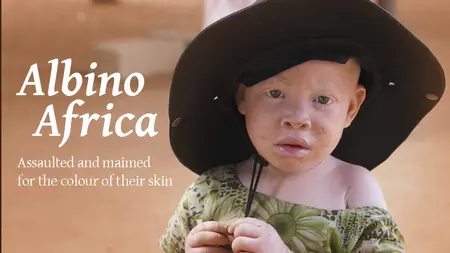 Albino Africa (2014)
