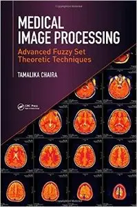 Medical Image Processing: Advanced Fuzzy Set Theoretic Techniques